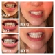 BLANQUEAMIENTO DENTAL FAIRYWILL